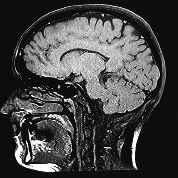 5 New Year’s resolutions to benefit the brain